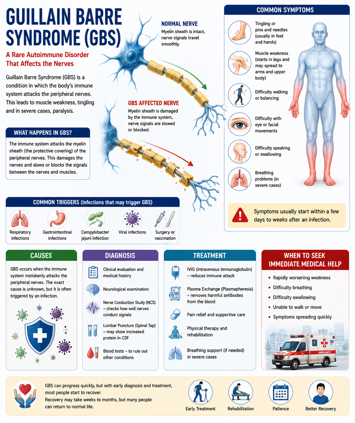 Guillain Barre Syndrome  ગિયાન બારે (GBS)