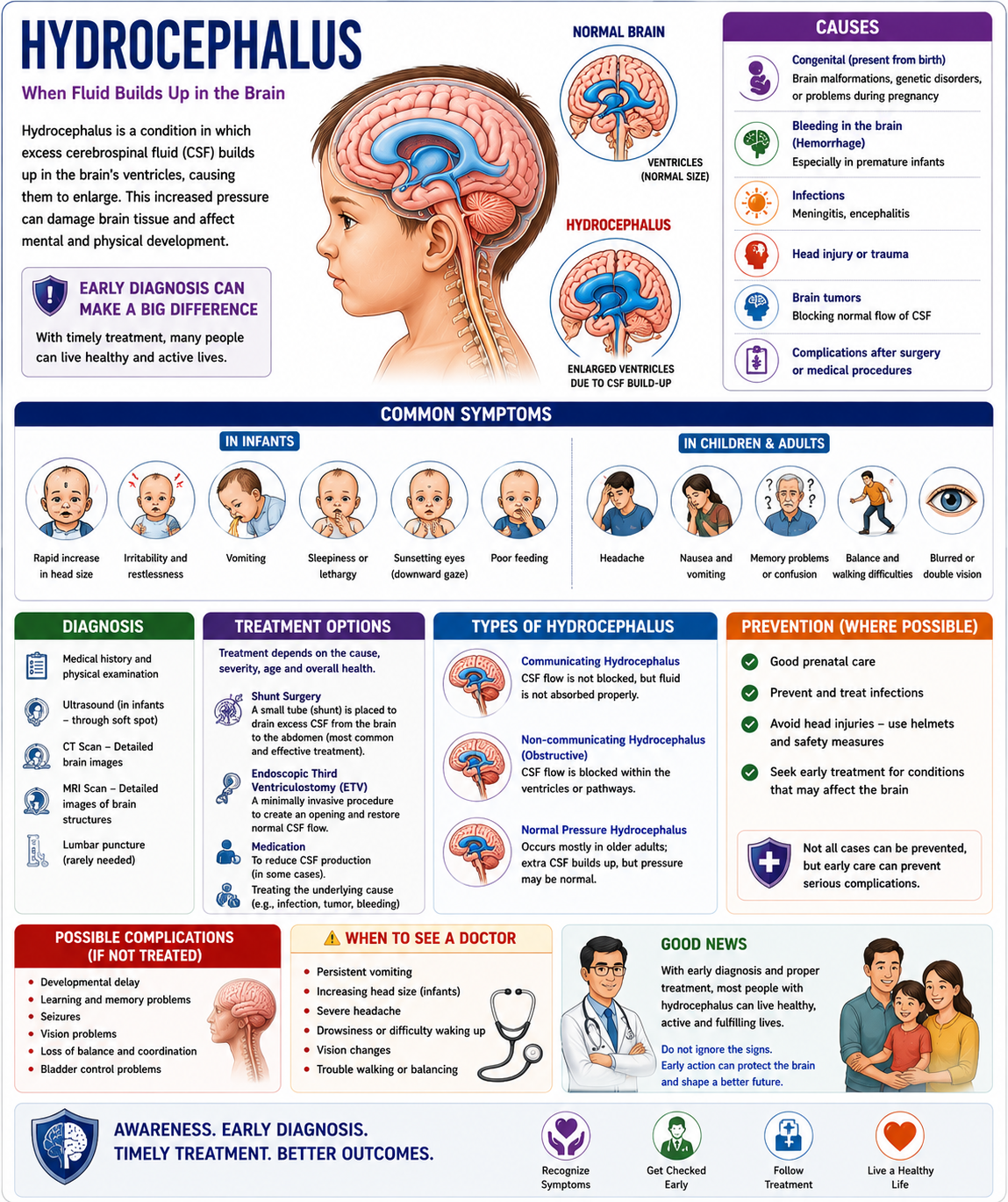 Hydrocephalus  મગજમાં પાણી ભરાવવું
